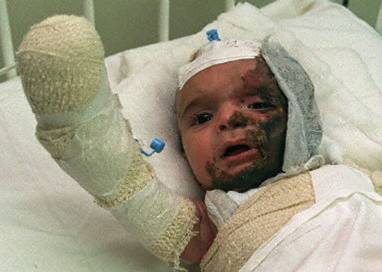 The wounded child